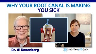 Why Your Root Canal is Making You Sick  Dr Al Danenberg [upl. by Solracsiul]