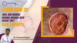 Wounds Bed sore  पुराने घाव ठीक करने का तरीका  Expert tipsquot  Vac Therapy by Dr Prashant Kumar [upl. by Dinesh]