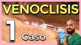 VENOCLISIS – Parte 5 CASO REAL 1 Cómo CANALIZAR una VENA [upl. by Zendah]