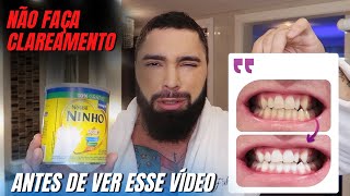 COMO FAZER CLAREAMENTO DENTAL CASEIRO COM LEITE EM PÓ E SMILINE [upl. by Graces]