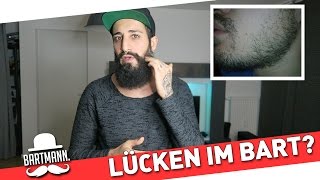 Lücken im Bart  Was tun BARTMANN [upl. by Eilhsa776]