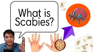 What is Scabies Is it Fungal Virus Bacteria or Parasite Nursing Review  NP1 [upl. by Alleynad]