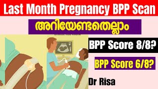 9 month Pregnancy ScanLast Month Pregnancy ScanWhat is BPP score [upl. by Link]