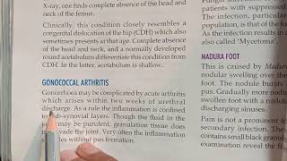 Gonococcal Arthritis [upl. by Llebiram]