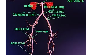 CT Lower Limb Angiography Anatomy CT scanPost processing avnishradiologypart1 [upl. by Almap756]