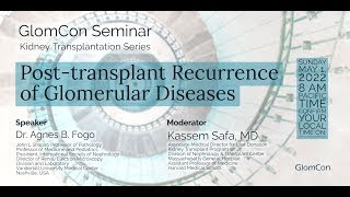 Post transplant Recurrence of Glomerular Diseases [upl. by Lovato]