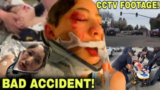 FOOTAGE of Nidal Wonder SCOOTER CRASH ACCIDENT 😱😳 TERRIBLE CAR ACCIDENT EXPLAINED [upl. by Gwyneth]