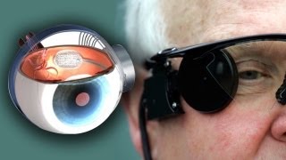 Bionic Eye Cures Blindness [upl. by Eiramoj]