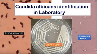 Candida growth on SDA Gram stain and Germ tube test Positive [upl. by Lauzon868]