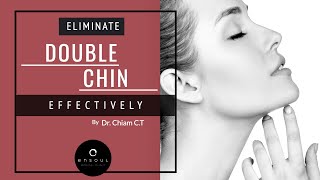 Types of Double Chin amp Your Treatment Options  Dr Chiam CT [upl. by Hollander386]