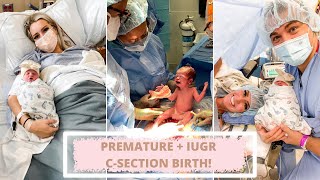 BLAKELYS BIRTH STORY  IUGR PREEMIE   RAW EMOTIONAL FOOTAGE   C SECTION [upl. by Ozner]