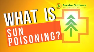 What is Sun Poisoning How to Treat [upl. by Notluf99]