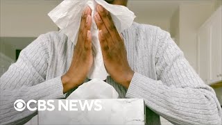 How allergies and weather changes could trigger a migraine [upl. by Amand]