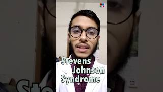 Stevens Johnson Syndrome  Sulfonamide  Penicillin  Antibiotics  Adverse effects [upl. by Dorlisa]