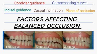 Factors affecting Balanced OcclusionHanaus quint in complete dentureOcclusion in Complete denture [upl. by Aenej]