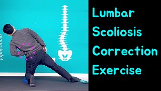 Lumbar Scoliosis Schroth Method Exercise Scoliosis Correction Single Curved Spine [upl. by Tessie]