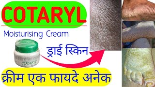 COTARYL Skin Cream Uses  What is Hyperkeratotic skin and Ichthyosis skin and its tretments [upl. by Yseulta]