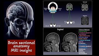 Brain Sectional anatomy on MRI Basa ganglia Caudate nucleus Putamen Globus pallidus [upl. by Leizahaj744]