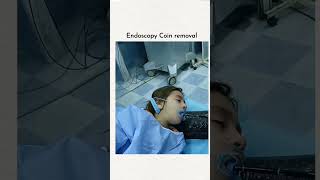 Endoscopy coin removel [upl. by Naginnarb]