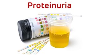 Proteinuria Protein In Urine  Proteinuria  Definition Types And Causes [upl. by Ansley]