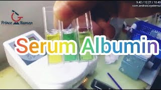 S Albumin Test Procedure in bangla সম্পুর্ন বাংলায় Prince Laboratory [upl. by Yralam]