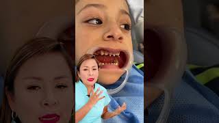 Una niña de 4 años recibiendo tratamiento de conducto y reconstruyendo sus dientecitos 👧🦷 [upl. by Tnerb]