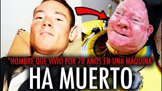 MUERE EL HOMBRE que vivió 70 años en UN PULMÓN DE ACERO [upl. by Perron]