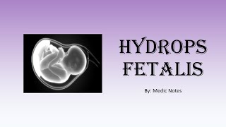 Hydrops fetalis  causes investigation management prognosis [upl. by Justino]