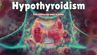 Hypothyroidism  Symptoms Causes Treatment amp Medication [upl. by Netsirhk4]