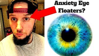 Anxiety Eye Floaters ANNOYING [upl. by Destinee]