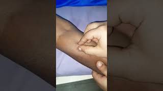 Skin Test Karna Kyu Jaruri hai  Skin me Injection Kaise lagaye Sensitive Skin Test Techniquevideo [upl. by Aivlis]