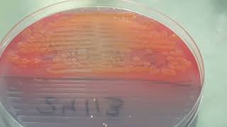 E coli Pseudomonas aeruginosa and Citrobacter freundii colony morphology on CLED agar [upl. by Ahseei]