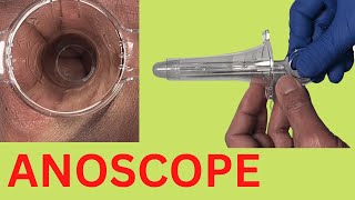 How Does an ANOSCOPE Work [upl. by Sharla]