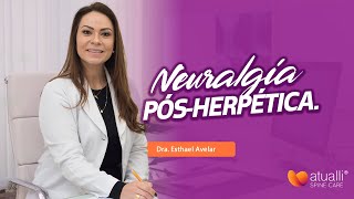 Neuralgia pós herpética [upl. by Till]