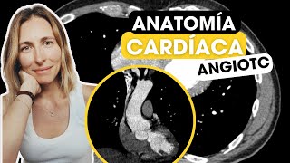 Todo lo que tienes que saber sobre anatomía cardíaca por TC✅ [upl. by Loggia]