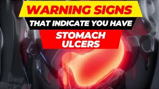 top 10 warning signs of stomach ulcers [upl. by Anyak539]