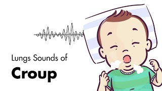 Sounds of Croup Laryngotracheitis  Lung Sounds  MEDZCOOL [upl. by Jonme]