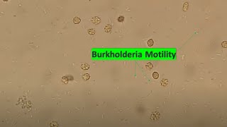 Burkholderia motility at various magnifications [upl. by Rois]