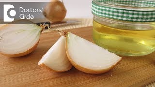 Time period required for hair regrowth after applying onion juice for hair loss  Dr Mini Nair [upl. by Aelanna]