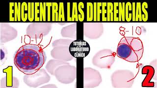 🩸Cómo Identificar Células Sanguíneas INMADURAS de la LÍNEA ROJAFases de EritropoyesisHematología🔬 [upl. by Verda]