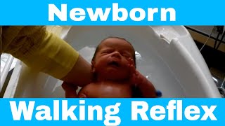 Primitive Reflex  Newborn Baby Walking Reflex Stepping Reflex [upl. by Serles230]