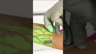 Vein finder facts knowledge didyouknow veinfinder medicaldevice science healthcare [upl. by Doak]