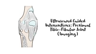 ultrasound Guided Interventions Proximal TibioFibular Joint Imaging [upl. by Ibbed119]