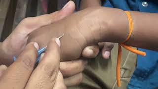 Iv Cannulation  cannula trending shorts youtube ​⁠ SMpharmacy subscribe [upl. by Asyar]