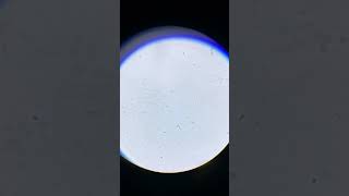 PROTOZOOS en agua estancada bajo el MICROSCOPIO [upl. by Lethia]