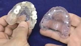 Radiographic and Surgical Implant Templates for the Completely Edentulous Fabrication Technique [upl. by Gothart]