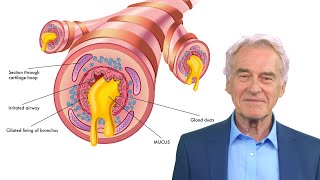 MUCUS PERSISTENT ÎN GÂT  cele mai frecvente 3 CAUZE [upl. by Solohcin379]