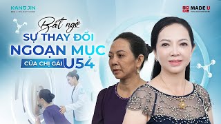 Da căng bóng xoá nhăn không phẫu thuật → Nhận phác đồ trẻ hoá từ Bác Sĩ [upl. by Minnie]