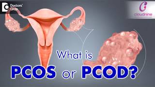 What is PCOS or PCOD  Dr Bandita Sinha of Cloudnine Hospitals  Doctors Circle [upl. by Nogas]