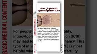 Intracytoplasmic Sperm Injection ICSI icsi ivf pregnancy sperm [upl. by Doubler]